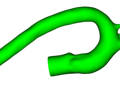 blood vessel CFD meshing example