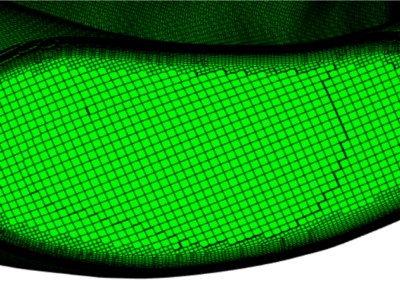 blood vessel CFD meshing example